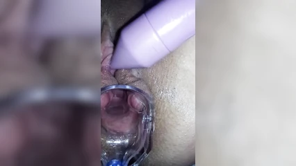 Role play at the gynecologist