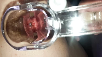 Homemade pranks with a speculum